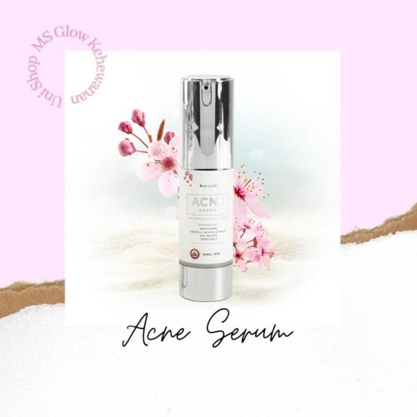 ms glow acne serum