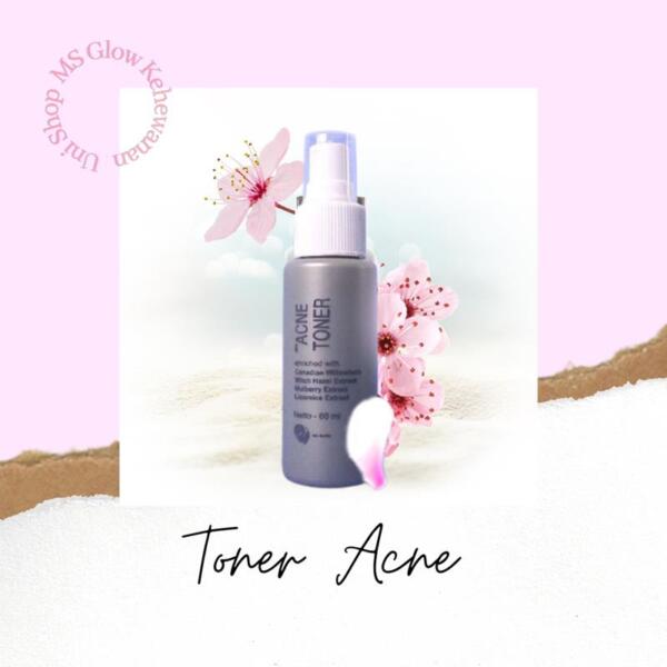 ms glow toner acne